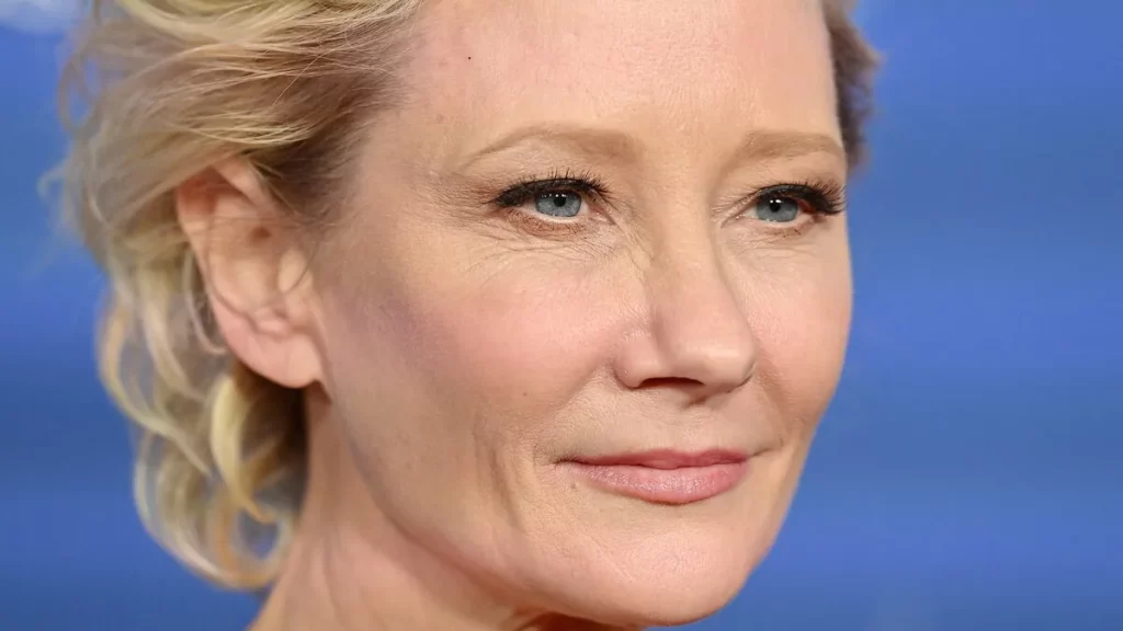 Autopsy Reveals Anne Heche’s Real Cause Of Death